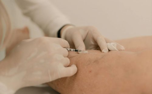 municipio-inaugura-clinica-vascular-municipal-para-cirurgias-e-exames-clinica-vai-oferecer-consultas-de-cirurgia-vascular-e-angiologia-exames-tratamento-de-varizes