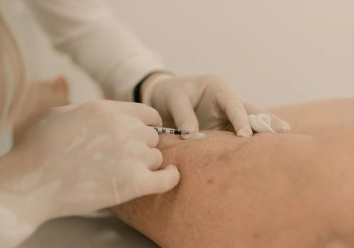 municipio-inaugura-clinica-vascular-municipal-para-cirurgias-e-exames-clinica-vai-oferecer-consultas-de-cirurgia-vascular-e-angiologia-exames-tratamento-de-varizes