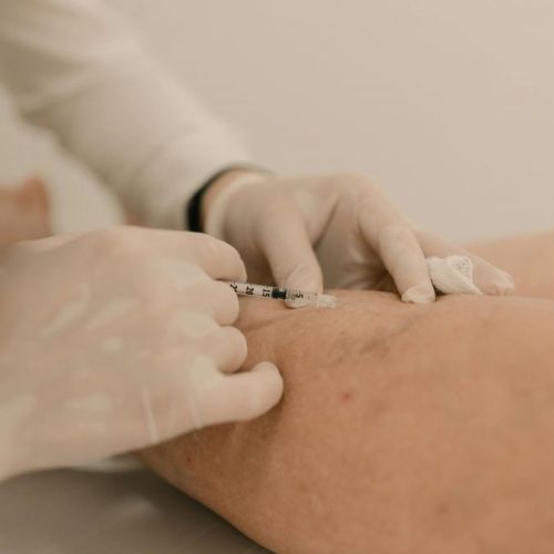 municipio-inaugura-clinica-vascular-municipal-para-cirurgias-e-exames-clinica-vai-oferecer-consultas-de-cirurgia-vascular-e-angiologia-exames-tratamento-de-varizes